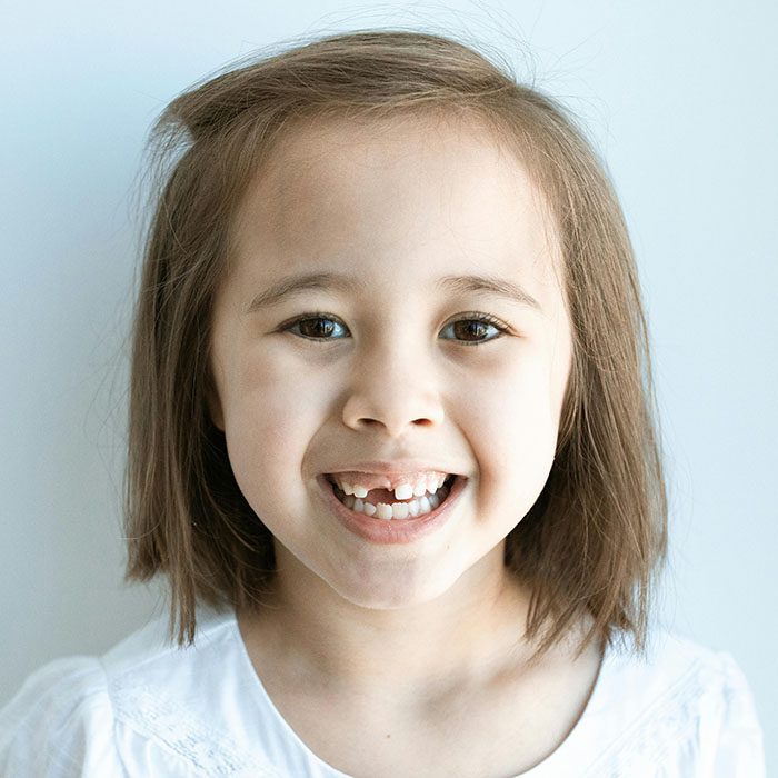 baby teeth traditions 2024 700 - A&M Dental Arts